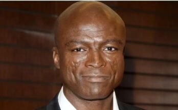 Why Singer Seal Has Scars on His Face - 3 Pics of What He Would Look Like without Them